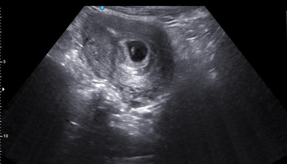 Meet My Wombmate Ultrasound Package