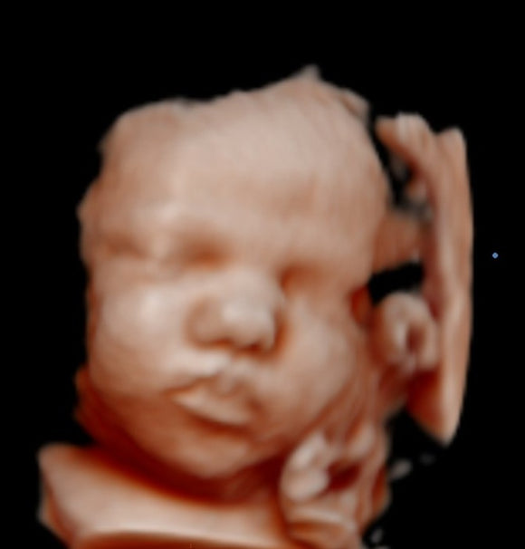 Baby Glimpsey Ultrasound Package
